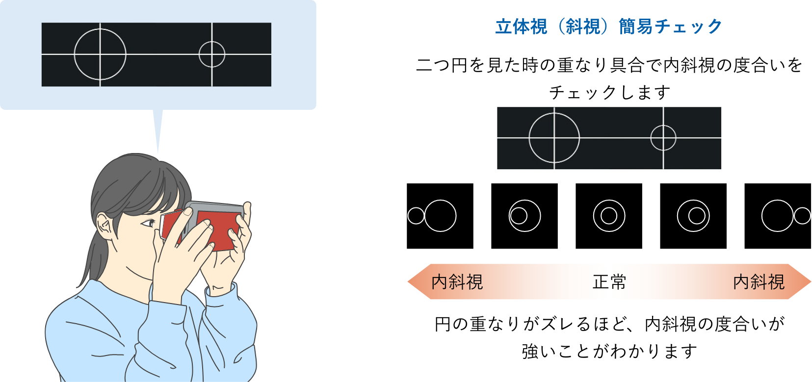 スマホで内斜視チェック